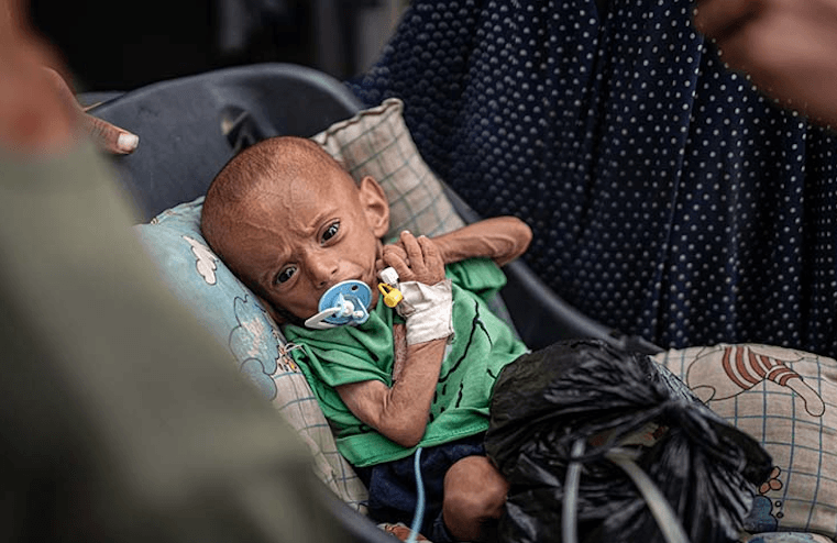 بالصور.. رضيع فلسطيني يواجه ثلاثية الموت 