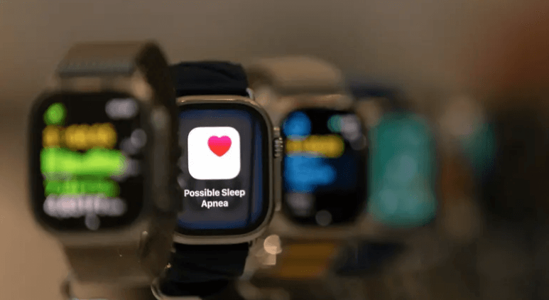 لماذا طال انتظار ميزة قياس ضغط الدم بساعات أبل؟