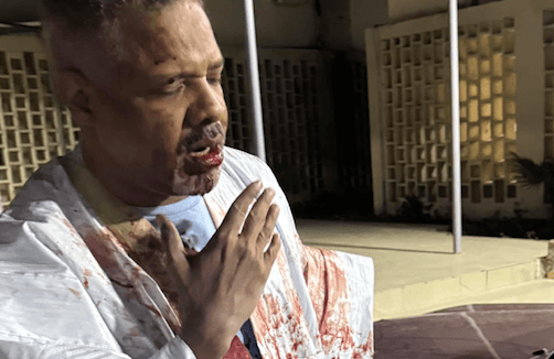 موريتانيا.. تنديد واسع بحادثة الاعتداء على مدير قناة (TTV)