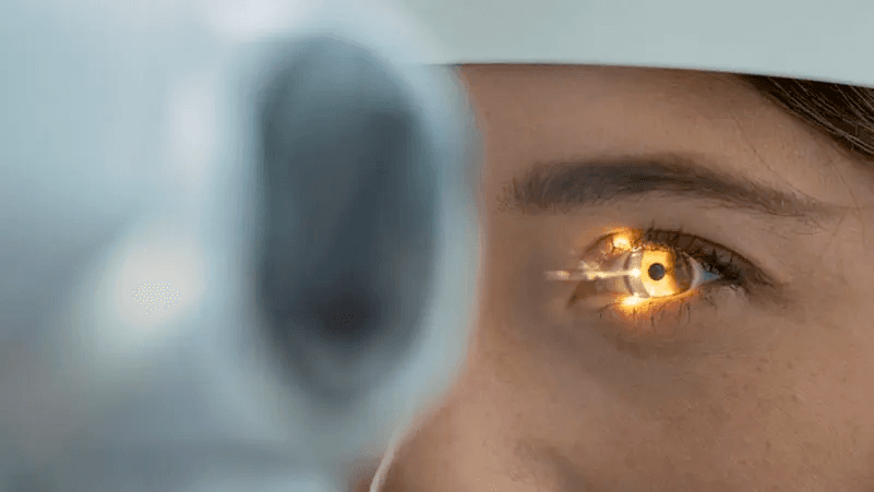 اكتشاف علمي يمهد لعلاج مبكر للمياه الزرقاء وحماية البصر