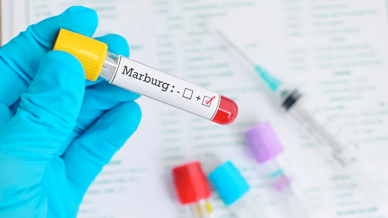 مصر تتخذ أقصى درجات التأهب لفيروس قاتل في إثيوبيا