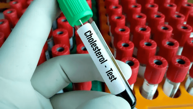 هل عُثر على مفتاح الكوليسترول؟ بروتين جديد يغيّر قواعد علاج أمراض القلب