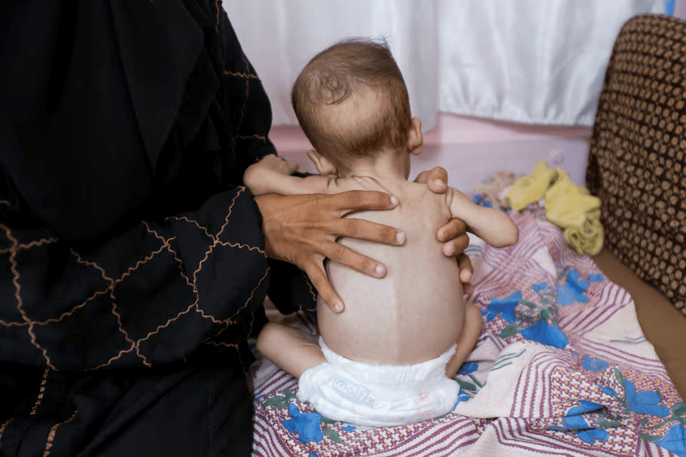 يونيسف تحذر: آلاف أطفال غزة يعانون سوء التغذية الحاد رغم الهدنة